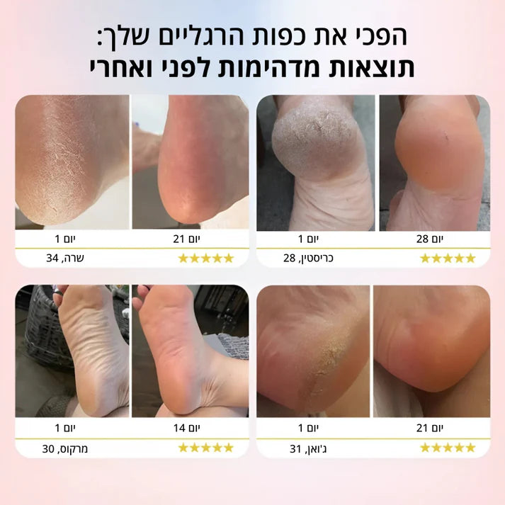 Boonality Smooth Pro – כולל 60 רפידות שיוף (במתנה)