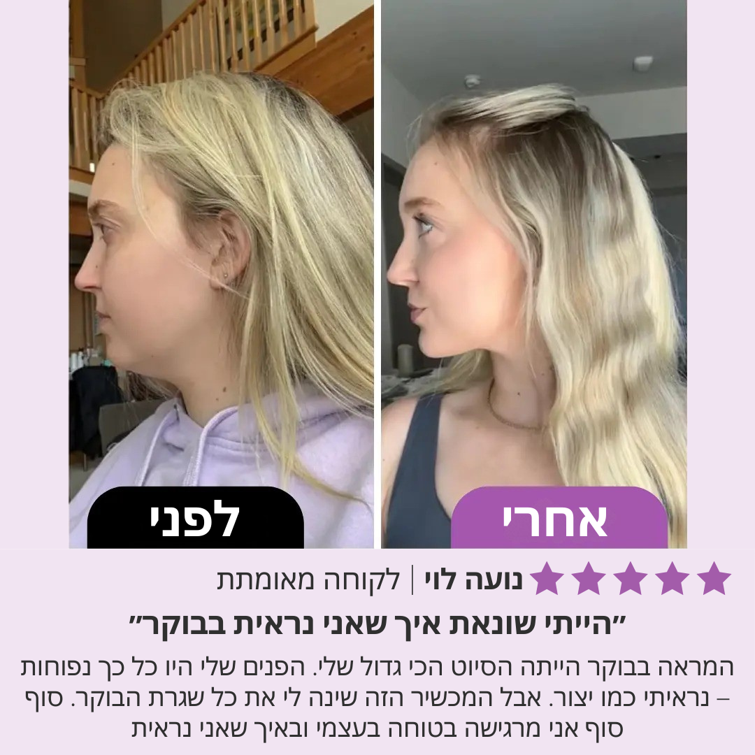 בונאליטי – רולר יופי לפנים